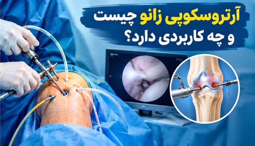 آرتروسکوپی زانو چیست و چه کاربردی دارد؟